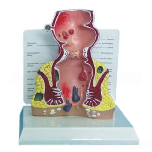 Human Rectal Anatomy Model