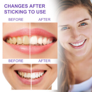 EELHOE Teeth Whitening Toothpaste, Removing Teeth Stains And Odors Oral Care Brightening And Whitening Teeth Toothpaste