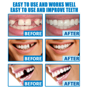 Jaysuing Moldable False Teeth, Film And Television Makeup Dentures Modified Dentures False Dentures Broken Teeth Temporary Dentures