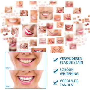 Tooth Whitening Pen