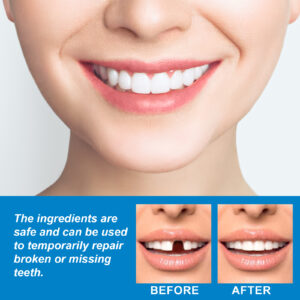 Jaysuing Moldable False Teeth, Film And Television Makeup Dentures Modified Dentures False Dentures Broken Teeth Temporary Dentures