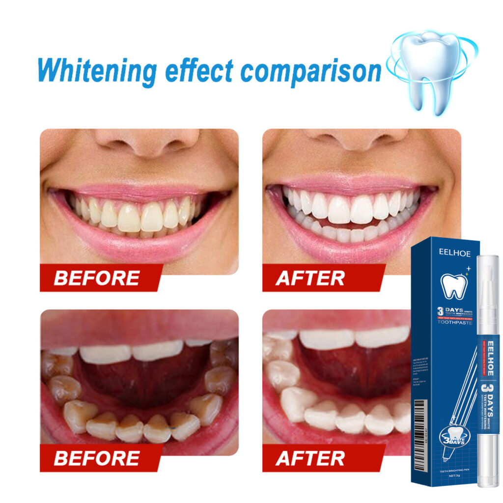 Teeth-cleaning Stain-removing Naturally Brightening Beauty Pen