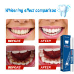 Teeth-cleaning Stain-removing Naturally Brightening Beauty Pen
