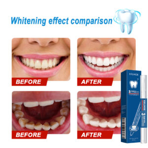 Teeth-cleaning Stain-removing Naturally Brightening Beauty Pen