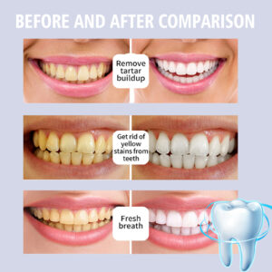 Teeth Stain Removal And Gum Care Serum