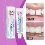 Denture Adhesive 20g