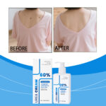 Urea Body Lotion