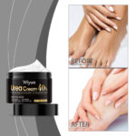 Hand And Foot Care Urea Cream